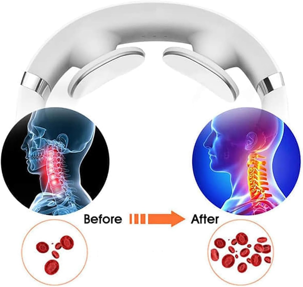 OGAWA OQ2602 Portable Wireless Neck Massager – White